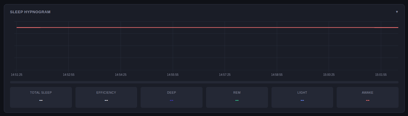 Sleep stage display with hypnogram and epoch details
